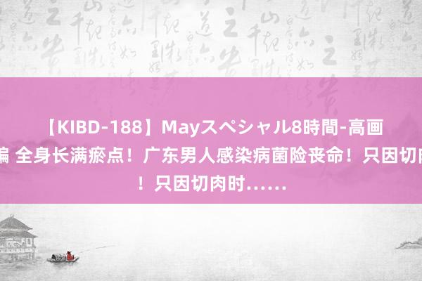 【KIBD-188】Mayスペシャル8時間-高画質-特別編 全身长满瘀点！广东男人感染病菌险丧命！只因切肉时……